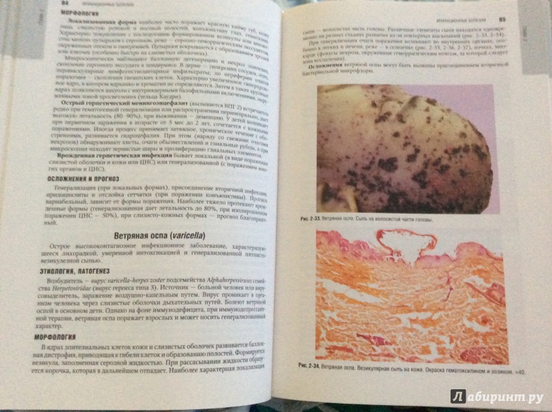 Иллюстрация 11 из 16 для Патологическая анатомия. Национальное руководство (+CD) - Пальцев, Кактурский, Зайратьянц | Лабиринт - книги. Источник: Angelina-161rus