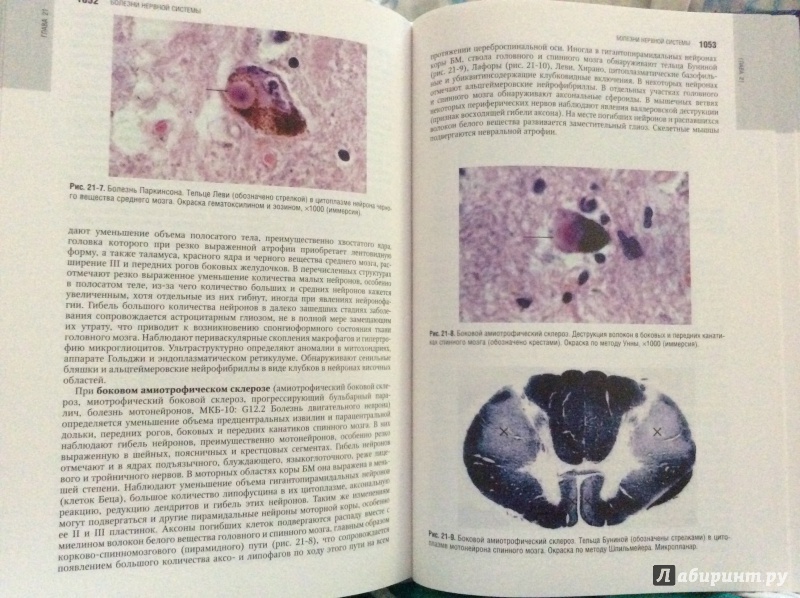 Иллюстрация 15 из 16 для Патологическая анатомия. Национальное руководство (+CD) - Пальцев, Кактурский, Зайратьянц | Лабиринт - книги. Источник: Angelina-161rus