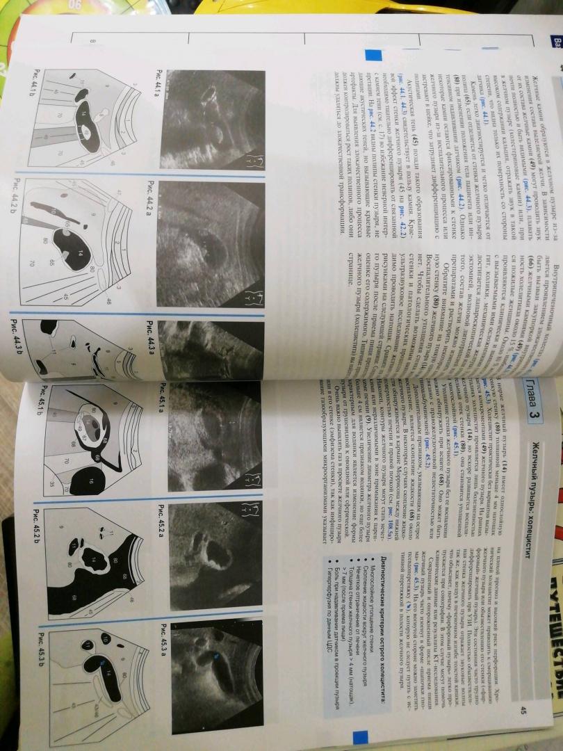 Иллюстрация 10 из 14 для Ультразвуковая диагностика. Базовый курс - Матиас Хофер | Лабиринт - книги. Источник: Ольга