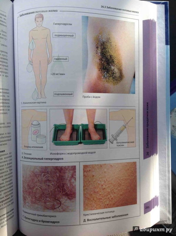 Иллюстрация 7 из 14 для Атлас по дерматологии - Бургдорф, Рекен, Шаллер, Заттлер | Лабиринт - книги. Источник: ВраЧиталла