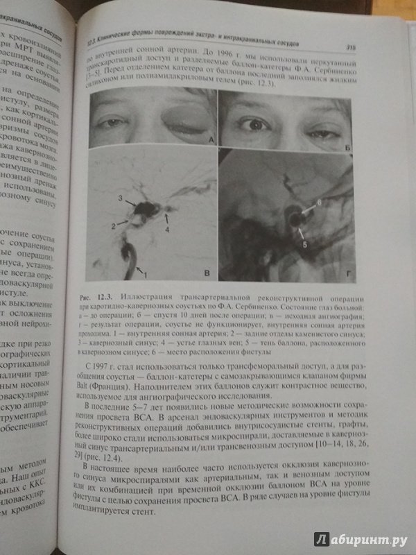 Иллюстрация 7 из 32 для Черепно-мозговая травма. Диагностика и лечение - Леонид Лихтерман | Лабиринт - книги. Источник: Кsena