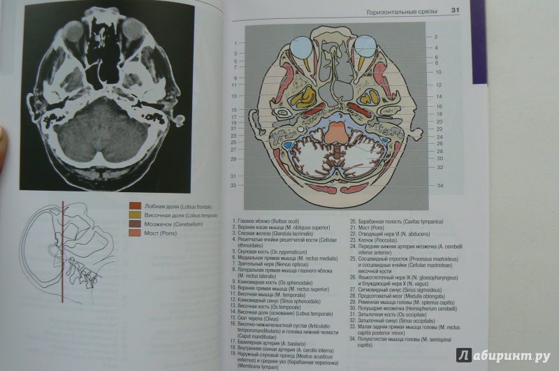 Иллюстрация 3 из 6 для Атлас секционной анатомии человека на примере КТ- и МРТ-срезов. Том 1. Голова и шея - Меллер, Райф | Лабиринт - книги. Источник: Марина