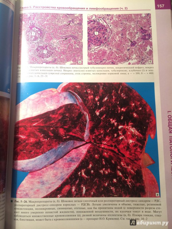 Иллюстрация 23 из 34 для Патологическая анатомия. Атлас. Учебное пособие - Зайратьянц, Бойкова, Зотова | Лабиринт - книги. Источник: | favouritevampire |