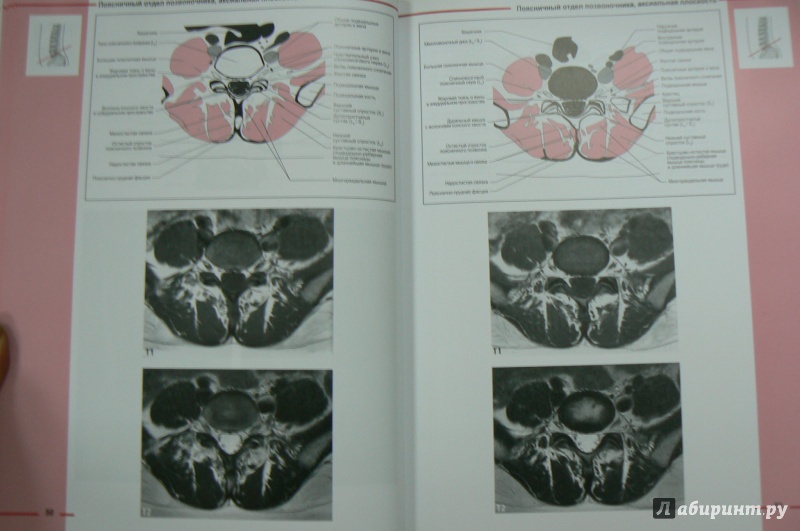 Иллюстрация 4 из 15 для МРТ костно-мышечной системы. Атлас - Роен, Лютьен-Дреколл, Хойк, Стайнборн | Лабиринт - книги. Источник: Марина
