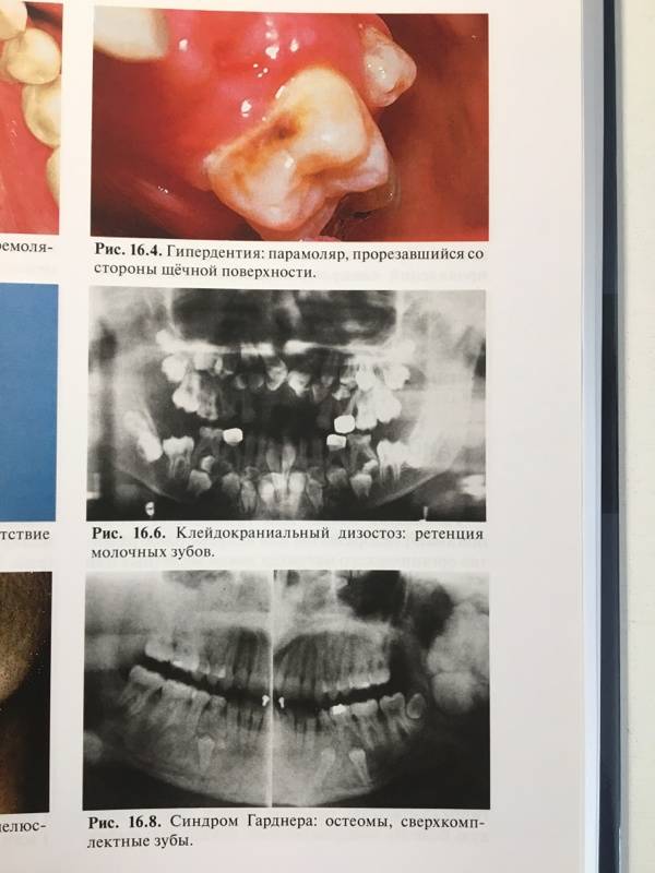 Иллюстрация 4 из 18 для Атлас заболеваний полости рта: Атлас - Лангле, Миллер | Лабиринт - книги. Источник: Shamaya
