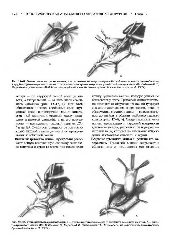 Иллюстрация 6 из 21 для Топографическая анатомия и оперативная хирургия. В 2 томах. Том 2 - Сергиенко, Петросян, Фраучи | Лабиринт - книги. Источник: Ялина