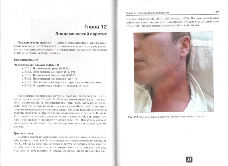 Иллюстрация 5 из 9 для Атлас инфекционных болезней - Лучшев, Жаров, Никифоров | Лабиринт - книги. Источник: ВраЧиталла