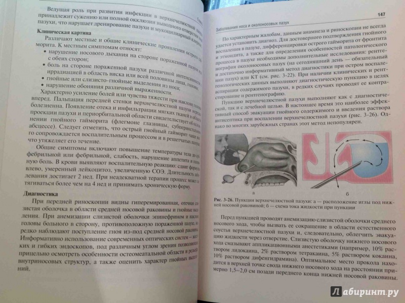 Иллюстрация 6 из 42 для Оториноларингология. Учебник - Пальчун, Лучихин, Магомедов | Лабиринт - книги. Источник: ВраЧиталла