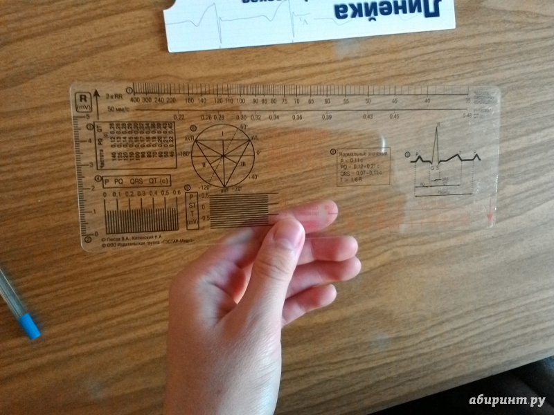 Иллюстрация 4 из 8 для Линейка измерительная электрокардиографическая | Лабиринт - книги. Источник: Angreniel