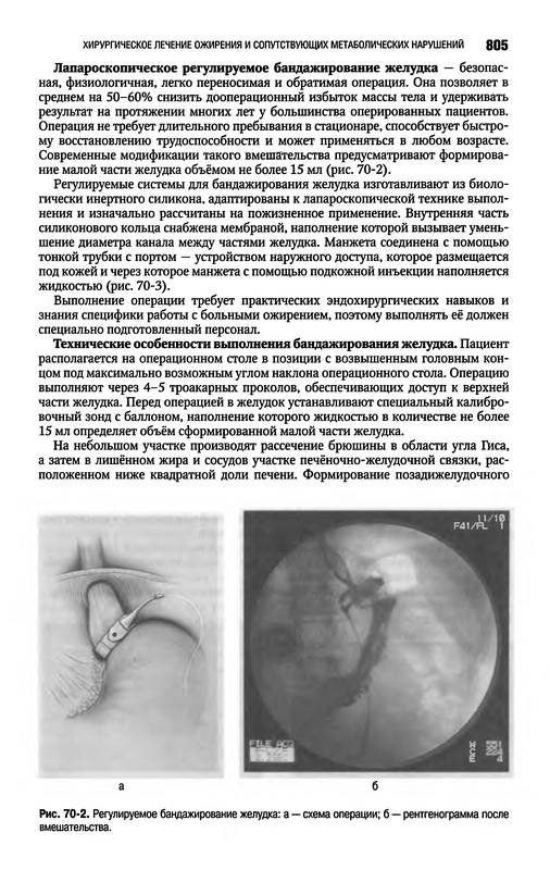 Иллюстрация 38 из 59 для Клиническая хирургия. Национальное руководство. В 3-х томах. Том 2 (+CD) | Лабиринт - книги. Источник: Ялина