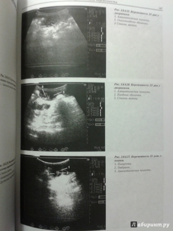Иллюстрация 7 из 7 для Клиническое ультразвуковое исследование органов брюшной и грудной полости. Атлас - В. Иванов | Лабиринт - книги. Источник: Шнурок