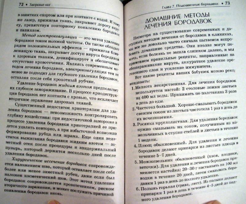 Иллюстрация 10 из 10 для Здоровье ног. Мозоли и натоптыши, бородавки стопы и шпоры, трещины и микозы - Е.М. Савельева | Лабиринт - книги. Источник: Качура Светлана Анатольевна