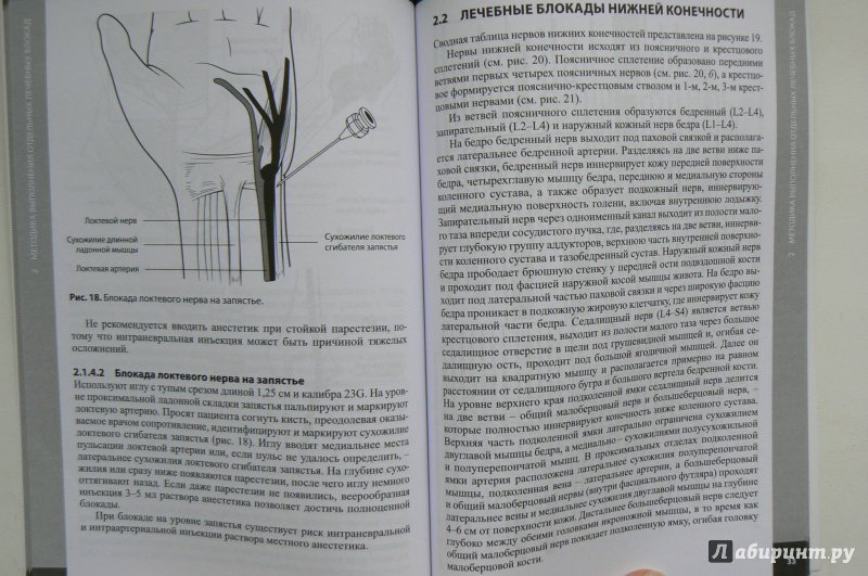 Иллюстрация 5 из 6 для Лечение боли. Методы локального воздействия - Загорулько, Медведева | Лабиринт - книги. Источник: Марина
