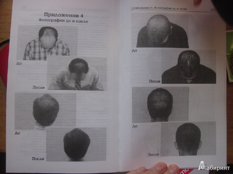 Иллюстрация 3 из 13 для Как остановить выпадение волос - Рикетт Гофштейн | Лабиринт - книги. Источник: товарищ маузер