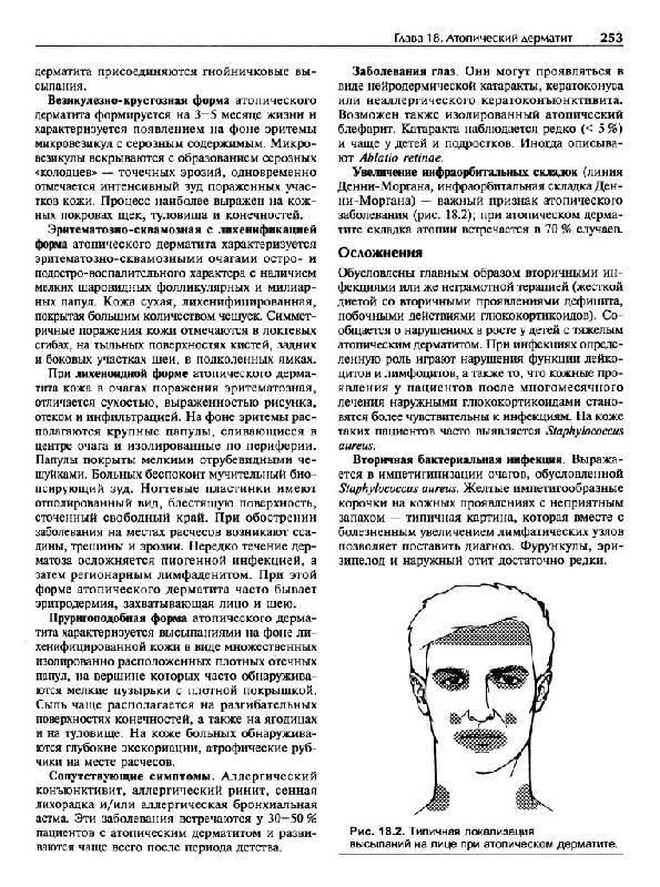 Иллюстрация 13 из 33 для Кожные и венерические болезни - Адаскевич, Козин | Лабиринт - книги. Источник: Юта