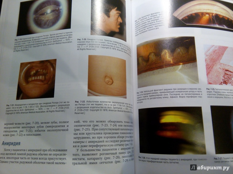 Иллюстрация 3 из 13 для Атлас по гониоскопии (+CD) - Олвэрд, Лонгмуа | Лабиринт - книги. Источник: Моисеев  Роман