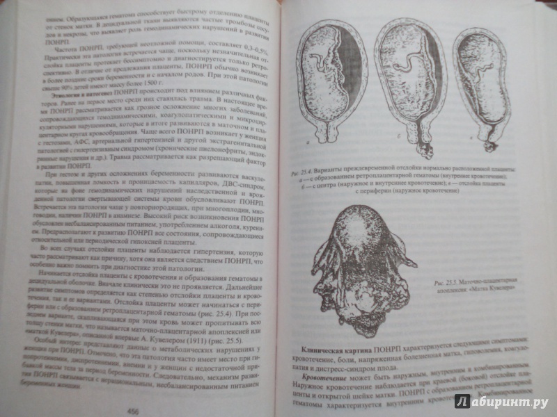 Иллюстрация 27 из 32 для Акушерство - Виталий Дуда | Лабиринт - книги. Источник: Кувшинова  Таня Константиновна