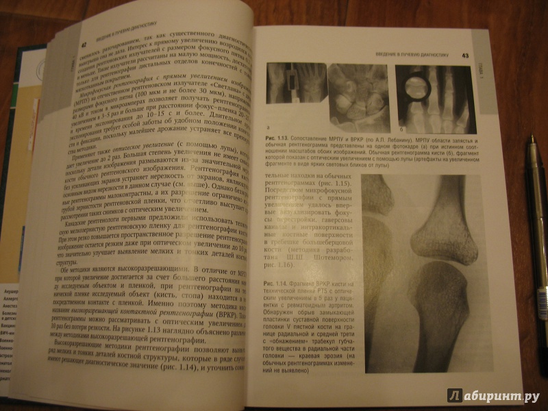 Иллюстрация 3 из 11 для Лучевая диагностика заболеваний костей и суставов. Национальное руководство | Лабиринт - книги. Источник: Крелена