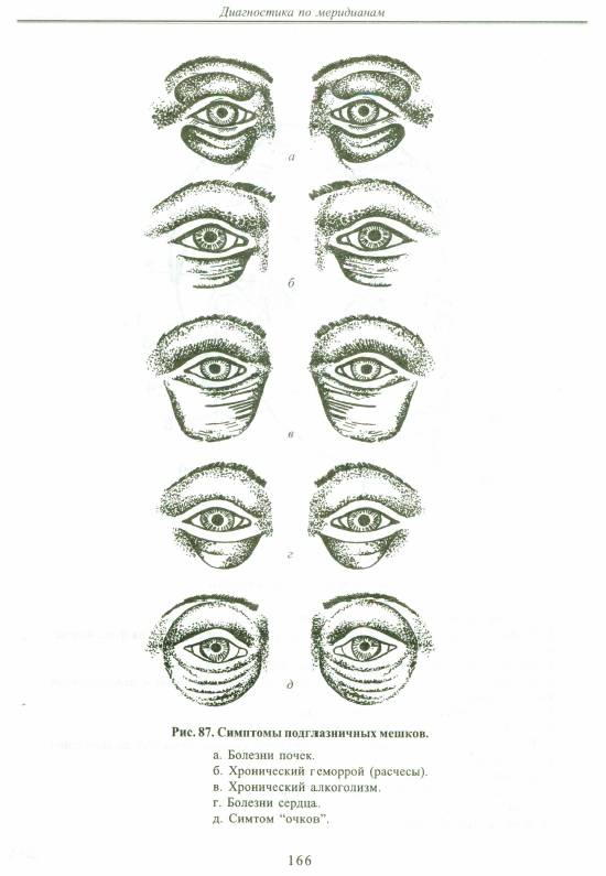 Иллюстрация 16 из 47 для Искусство диагностики по лицу. Атлас - Эмма Гоникман | Лабиринт - книги. Источник: Joker