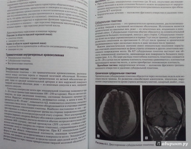 Иллюстрация 6 из 12 для Частная неврология - Суслина, Максимова | Лабиринт - книги. Источник: Савостин  Александр