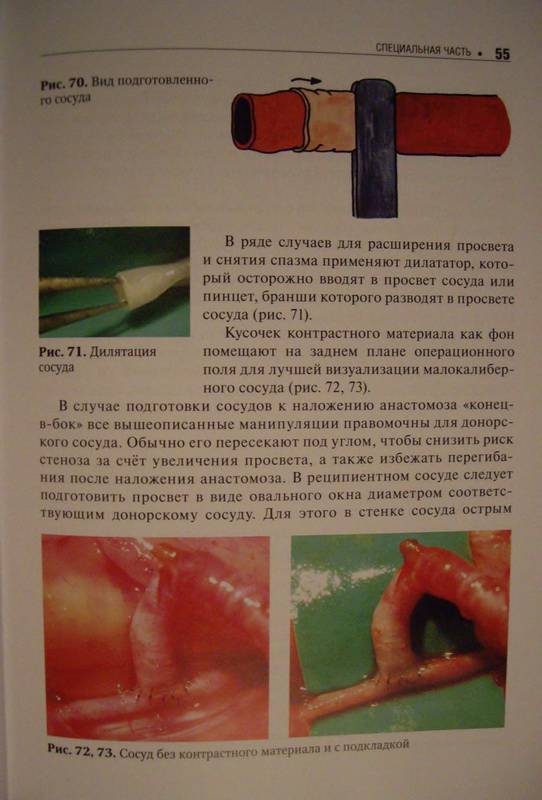 Иллюстрация 11 из 13 для Основы микрохирургии - Геворков, Мартиросян, Дыдыкин, Элиава | Лабиринт - книги. Источник: Ялина