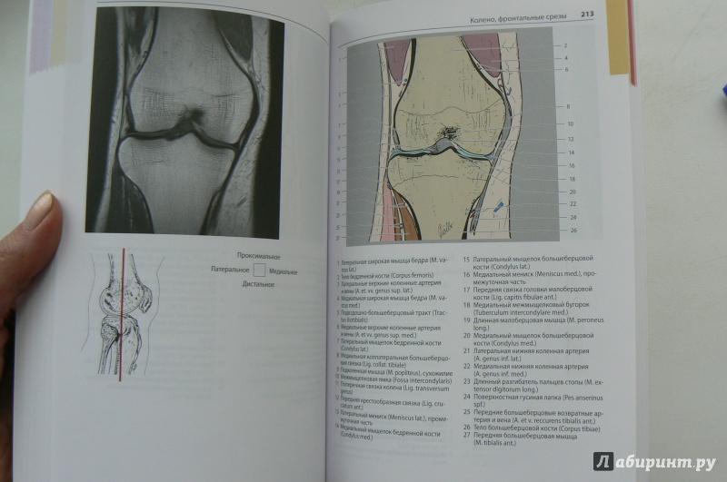 Иллюстрация 5 из 12 для Атлас секционной анатомии человека на примере КТ- и МРТ-срезов. Том 3. Позвоночник, конечности - Меллер, Райф | Лабиринт - книги. Источник: Марина