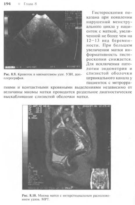 Иллюстрация 22 из 26 для Гинекология | Лабиринт - книги. Источник: Федосов  Прохор Сергеевич
