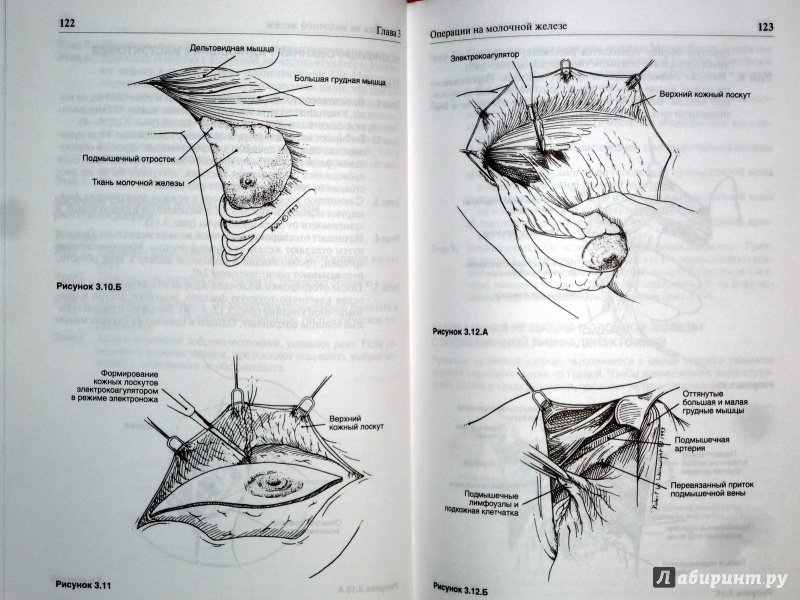 Иллюстрация 13 из 19 для Оперативная хирургия - Скандалакис, Скандалакис, Скандалакис | Лабиринт - книги. Источник: Лабиринт