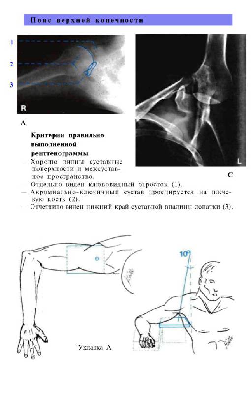 Иллюстрация 26 из 29 для Атлас рентгенологических укладок - Меллер, Райф | Лабиринт - книги. Источник: Юта