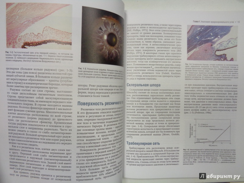 Иллюстрация 9 из 13 для Атлас по гониоскопии (+CD) - Олвэрд, Лонгмуа | Лабиринт - книги. Источник: Сокол-Ан
