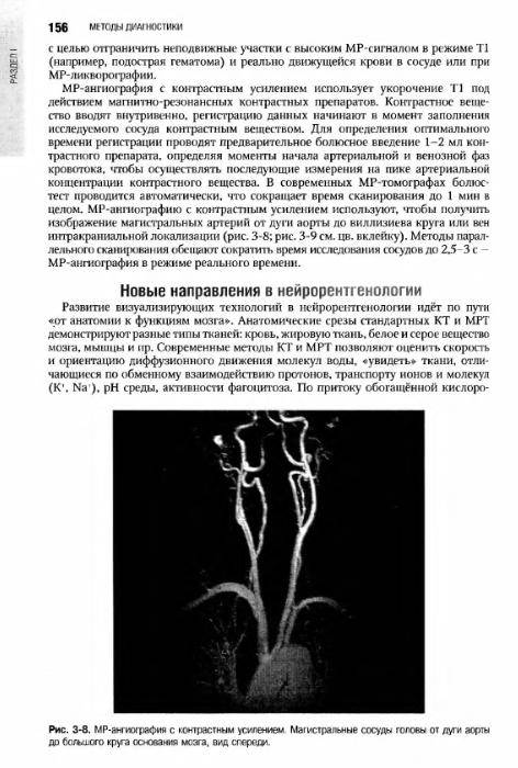 Иллюстрация 42 из 55 для Неврология: национальное руководство (+CD) | Лабиринт - книги. Источник: Федосов  Прохор Сергеевич