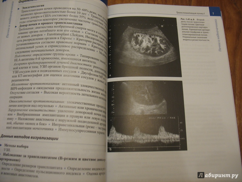 Иллюстрация 23 из 23 для Лучевая диагностика. Болезни мочеполовой системы - Хамм, Асбах, Бейерсдорф, Хайн, Лемке | Лабиринт - книги. Источник: Крелена
