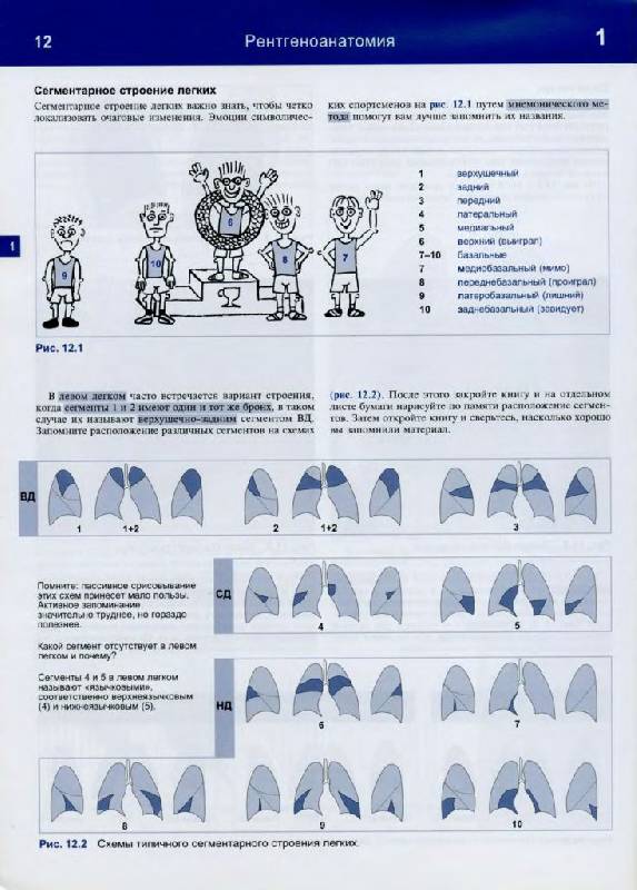 Иллюстрация 8 из 32 для Рентгенологическое исследование грудной клетки. Практическое руководство - Матиас Хофер | Лабиринт - книги. Источник: Юта