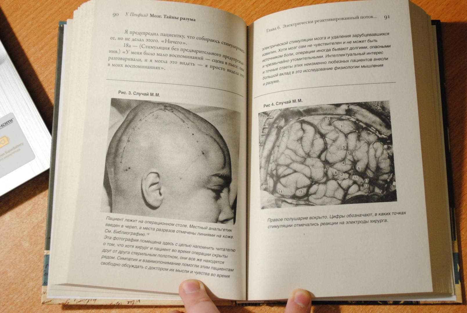 Иллюстрация 39 из 46 для Мозг. Тайны разума - Уайлдер Пенфилд | Лабиринт - книги. Источник: Бачкалов Егор