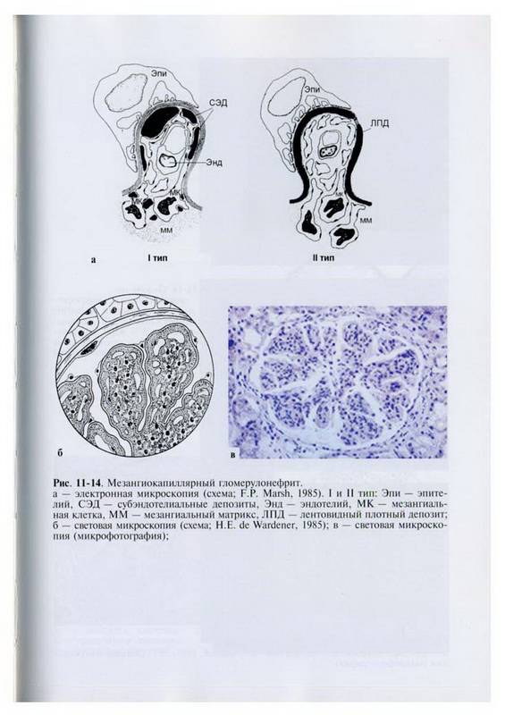 Иллюстрация 6 из 8 для Нефрология (+CD) | Лабиринт - книги. Источник: Ялина