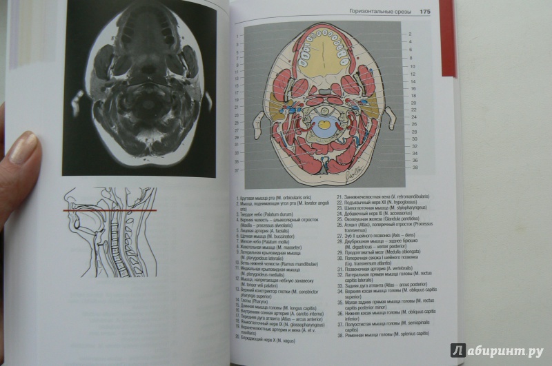 Иллюстрация 6 из 6 для Атлас секционной анатомии человека на примере КТ- и МРТ-срезов. Том 1. Голова и шея - Меллер, Райф | Лабиринт - книги. Источник: Марина