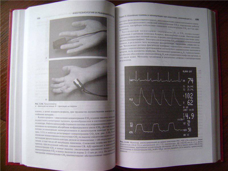 Иллюстрация 31 из 34 для Анестезиология и реаниматология. Учебник - Блинов, Бицунов, Бурлаков | Лабиринт - книги. Источник: AnnS