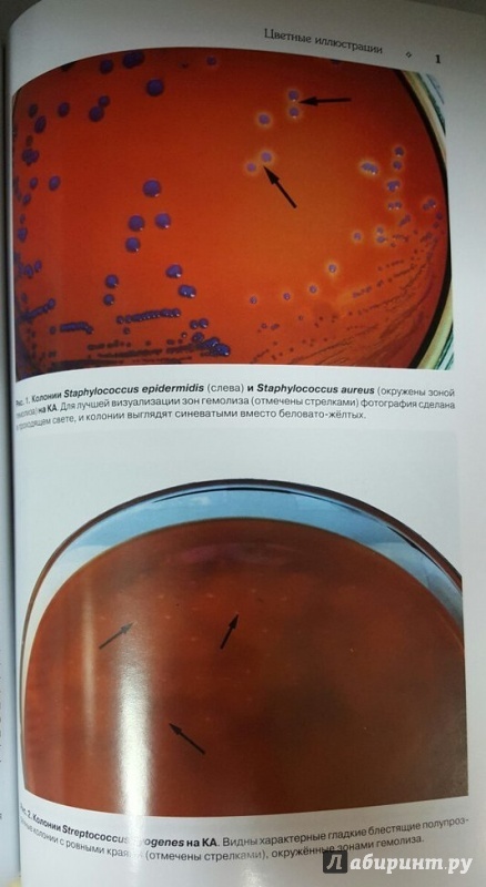 Иллюстрация 4 из 22 для Медицинская микробиология: учебное пособие - Оскар Поздеев | Лабиринт - книги. Источник: Den