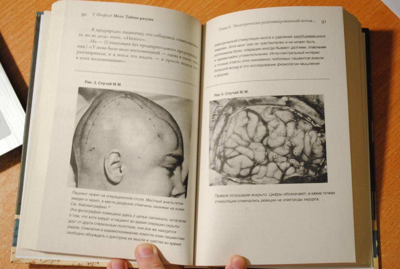 Иллюстрация 38 из 46 для Мозг. Тайны разума - Уайлдер Пенфилд | Лабиринт - книги. Источник: Бачкалов Егор