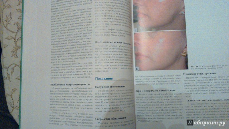 Иллюстрация 5 из 32 для Омоложение лица. Современные нехирургические методы | Лабиринт - книги. Источник: Варежка
