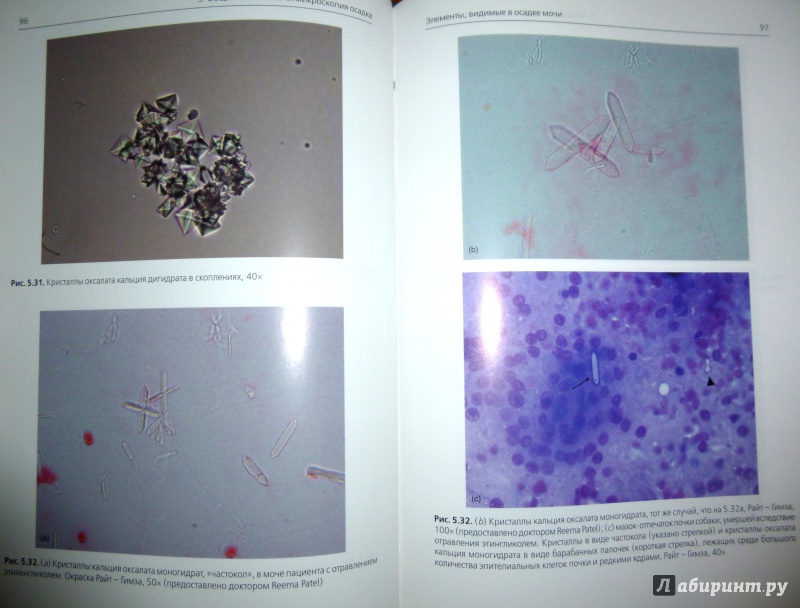 Иллюстрация 9 из 12 для Общий анализ мочи в ветеринарной медицине. Цветной атлас - Синк, Вейнштейн | Лабиринт - книги. Источник: Nadin