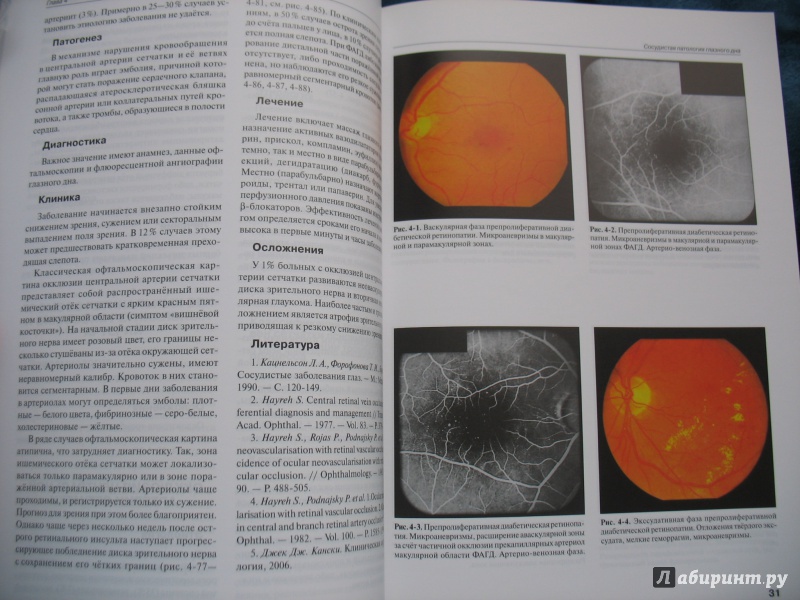 Иллюстрация 3 из 10 для Клинический атлас патологии глазного дна - Кацнельсон, Лысенко, Балишанская | Лабиринт - книги. Источник: Крелена