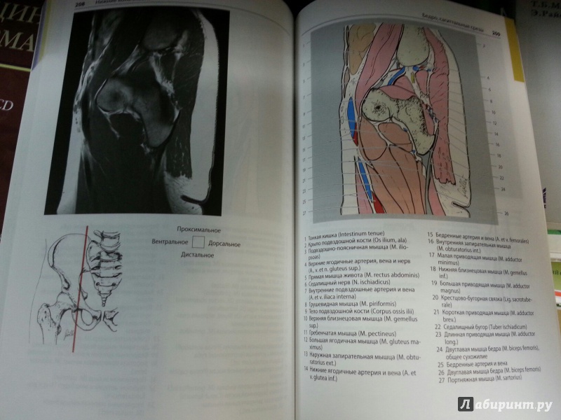 Иллюстрация 10 из 12 для Атлас секционной анатомии человека на примере КТ- и МРТ-срезов. Том 3. Позвоночник, конечности - Меллер, Райф | Лабиринт - книги. Источник: Den