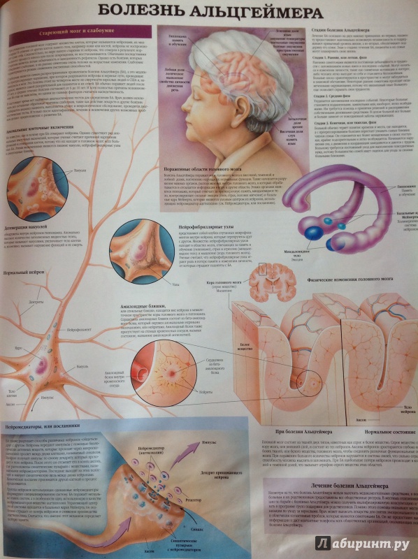 Иллюстрация 6 из 6 для Анатомия человека. Болезни и нарушения | Лабиринт - книги. Источник: katyleb
