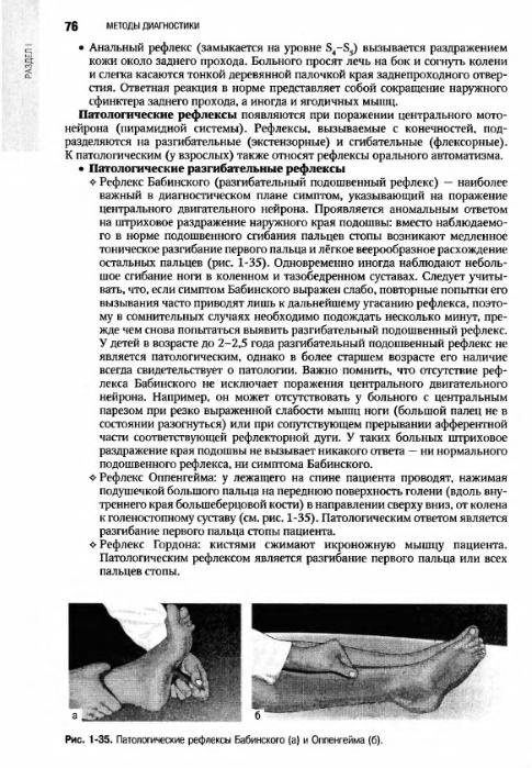 Иллюстрация 39 из 55 для Неврология: национальное руководство (+CD) | Лабиринт - книги. Источник: Федосов  Прохор Сергеевич