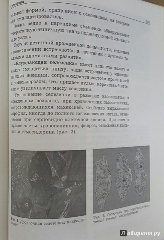 Иллюстрация 3 из 5 для Диагностика заболеваний печени, билиарного тракта, поджелудочной железы, селезенки (+CD) - Панфилова, Панфилов | Лабиринт - книги. Источник: Den