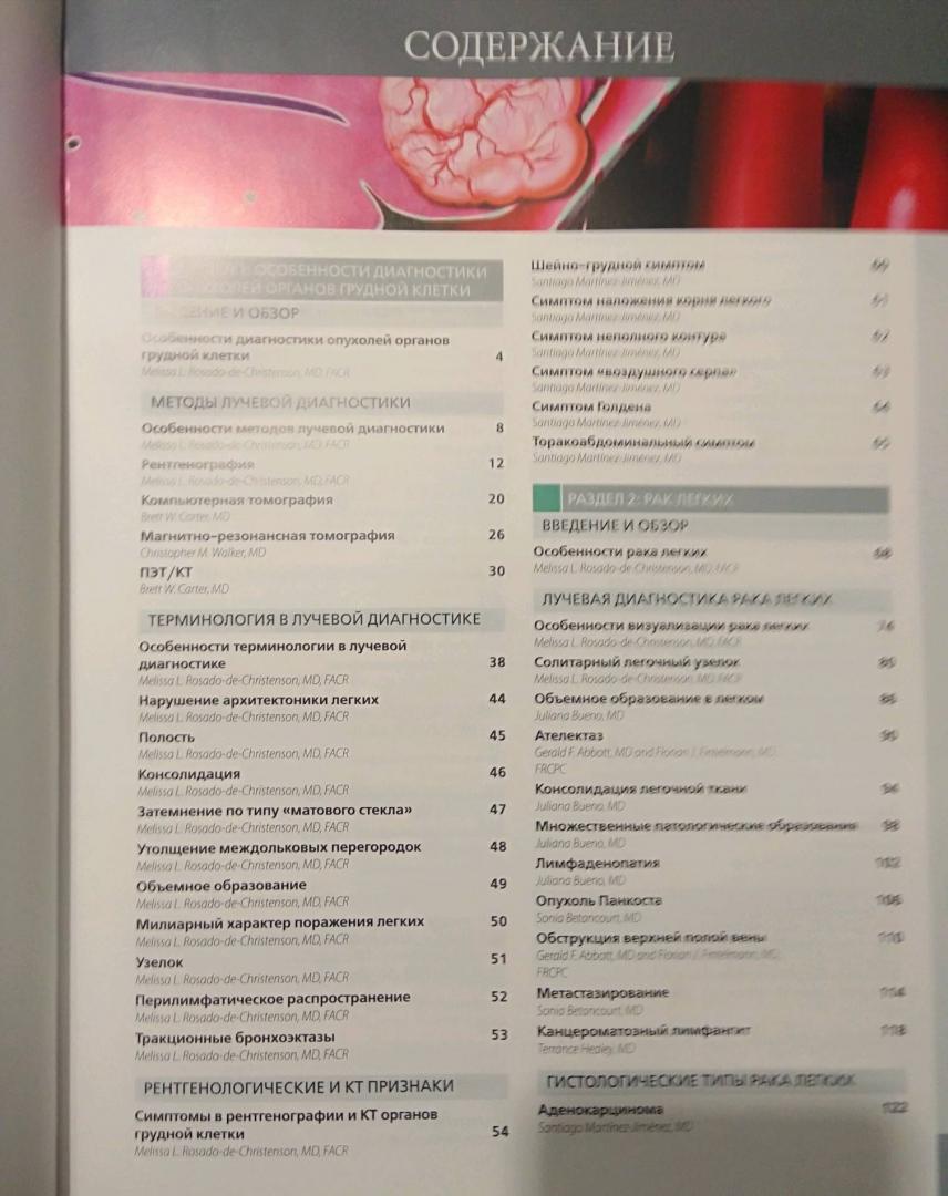 Иллюстрация 10 из 12 для Лучевая диагностика. Опухоли органов грудной клетки - Розадо-де-Кристенсон, Картер | Лабиринт - книги. Источник: Савчук Ирина