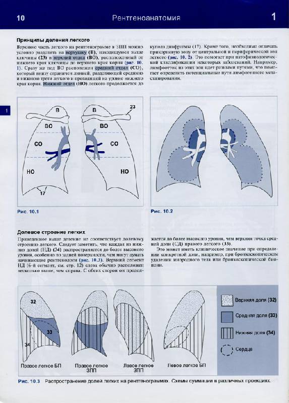 Иллюстрация 32 из 32 для Рентгенологическое исследование грудной клетки. Практическое руководство - Матиас Хофер | Лабиринт - книги. Источник: Кнопа2