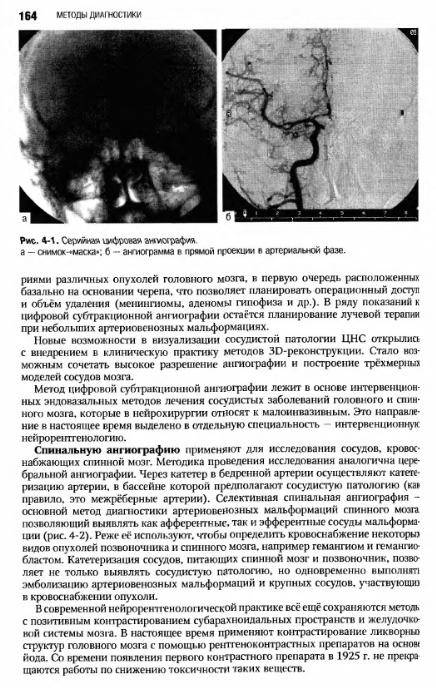 Иллюстрация 43 из 55 для Неврология: национальное руководство (+CD) | Лабиринт - книги. Источник: Федосов  Прохор Сергеевич