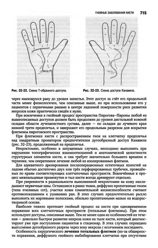 Иллюстрация 42 из 58 для Клиническая хирургия: национальное руководство. В 3-х томах. Том 1 (+CD) | Лабиринт - книги. Источник: Ялина